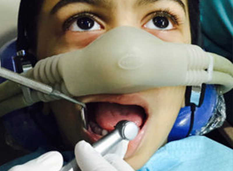tooth-extraction.jpg Botulinum Toxin