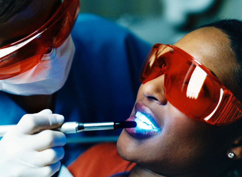 tooth-whitening Botulinum Toxin